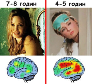 мозок